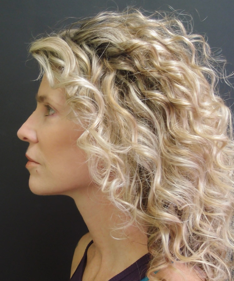 woman after facelift plastic surgery
