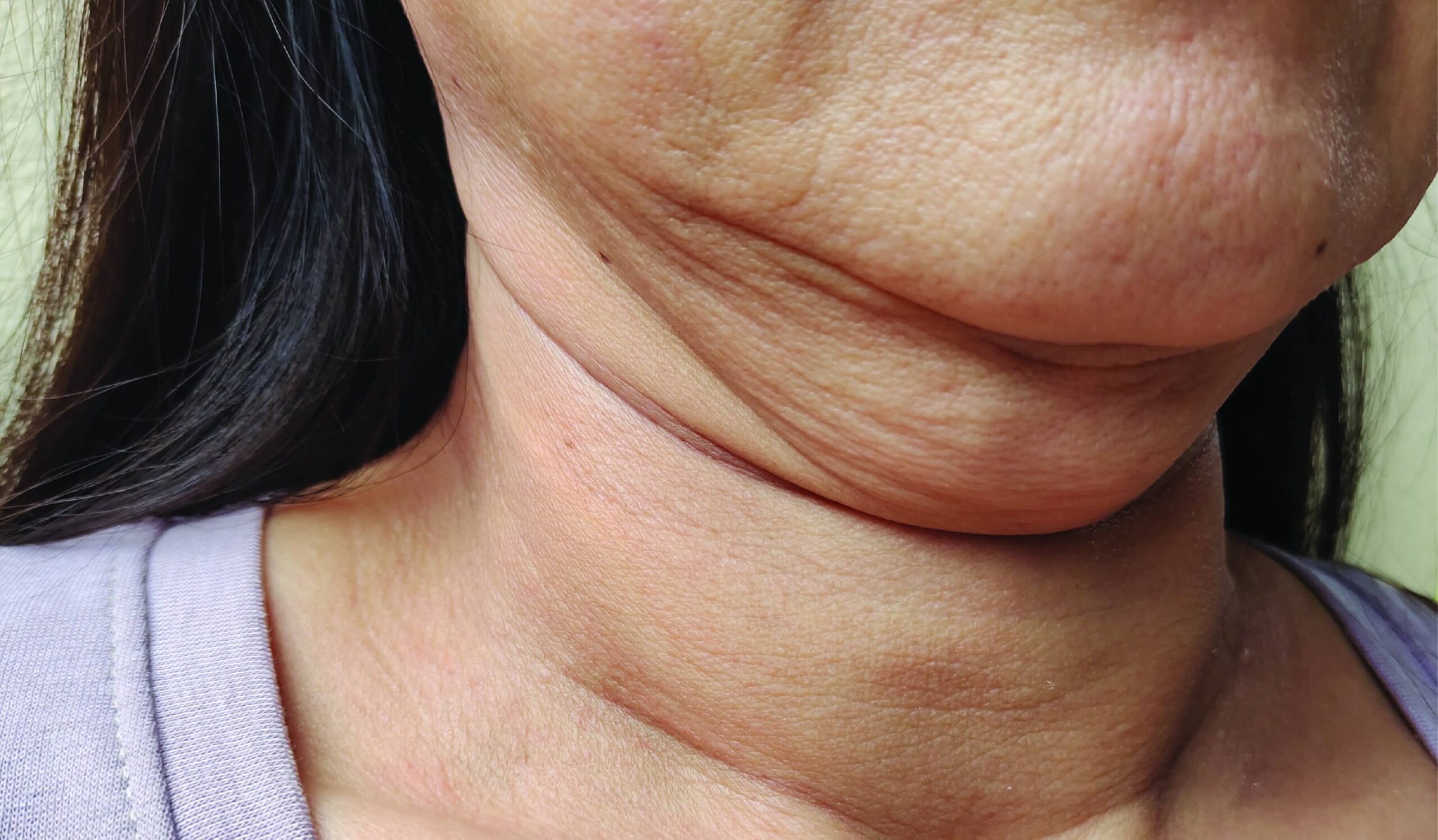 Woman with double chin