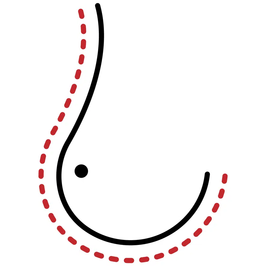 Breast lift icon symbolizing enhanced firmness and youthfulness at Advanced Institute for Plastic Surgery.
